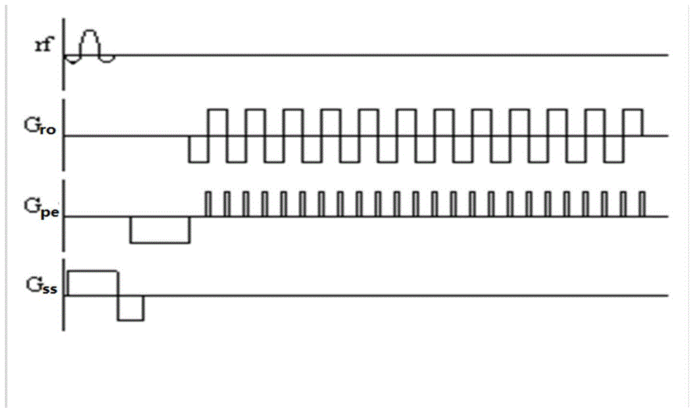 Echo planar imaging method and device