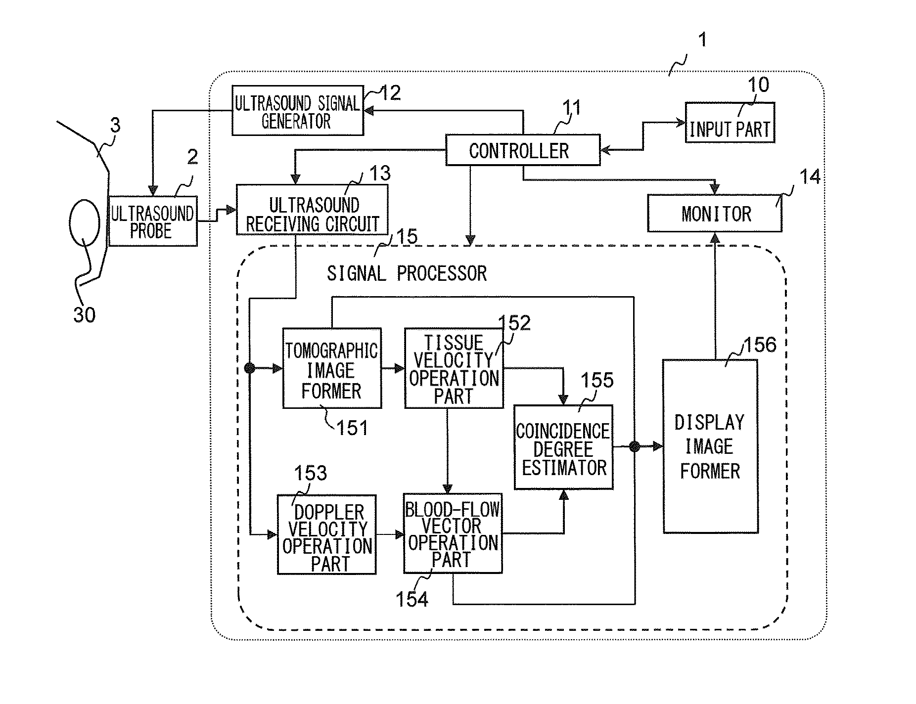 Ultrasound image capture device and ultrasound image capture method