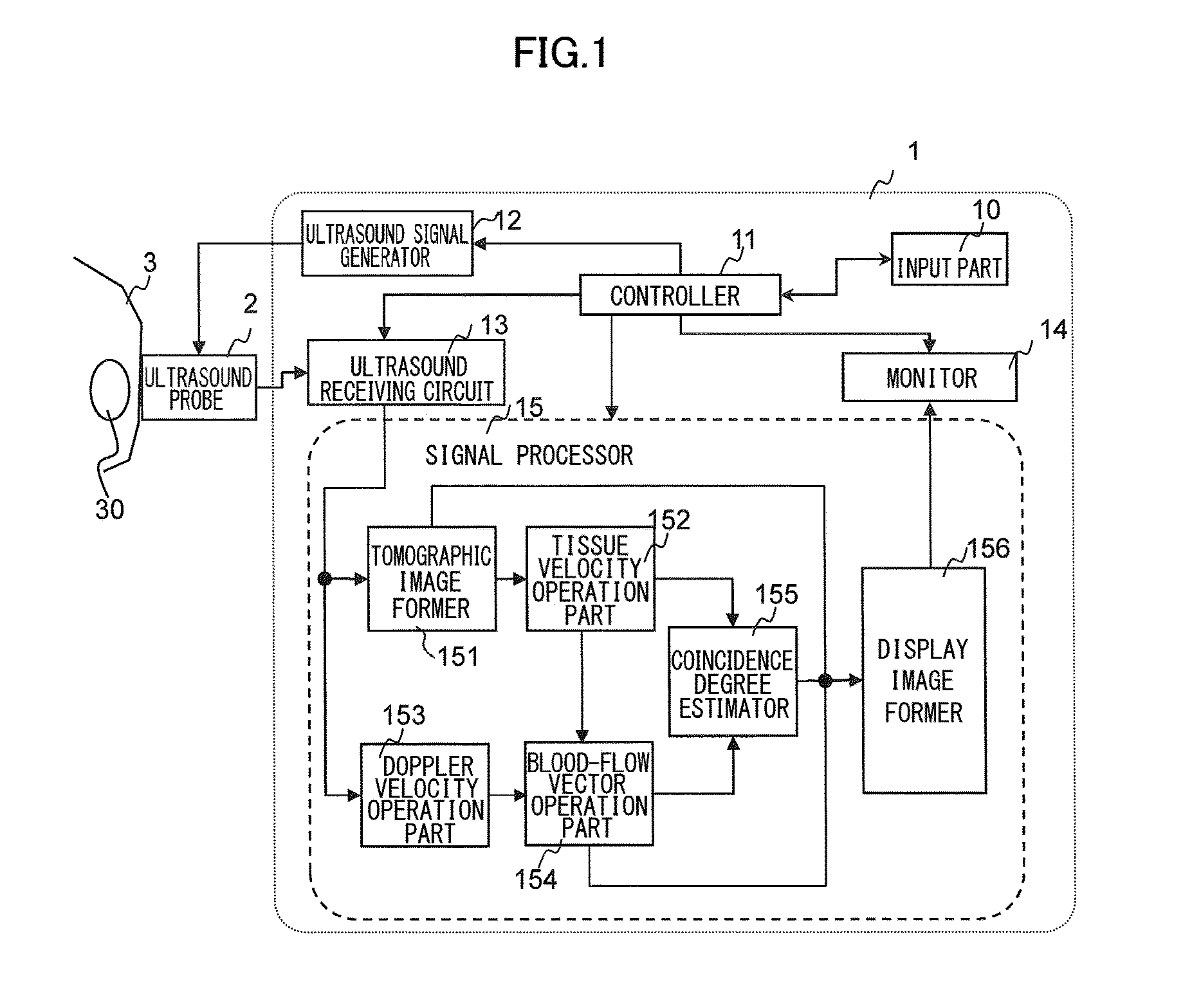 Ultrasound image capture device and ultrasound image capture method