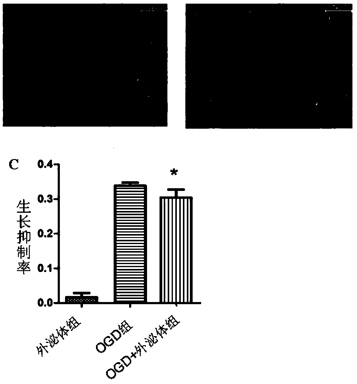 Preparation method and application of mesenchymal stem cell exosome