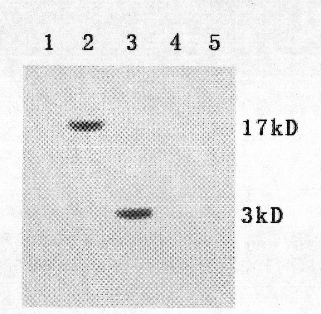 Monoclonal antibody of hepatitis B virus X protein and use thereof