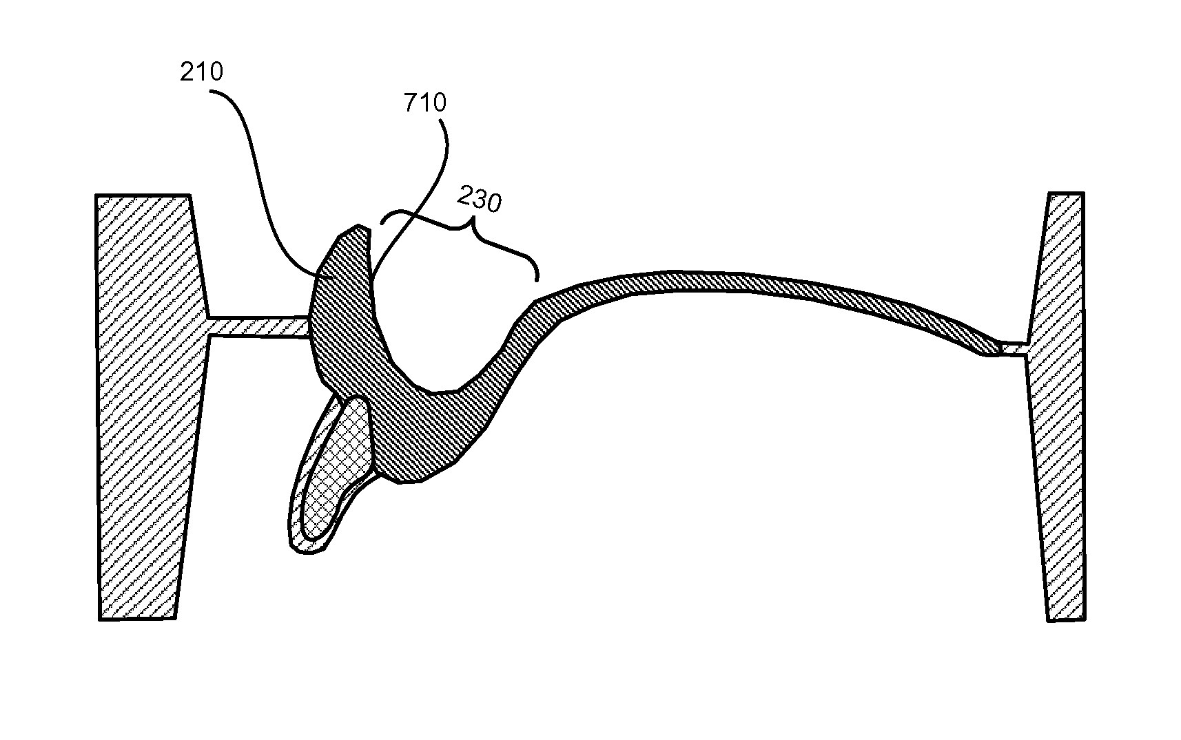 System and method for manufacturing layered dentures