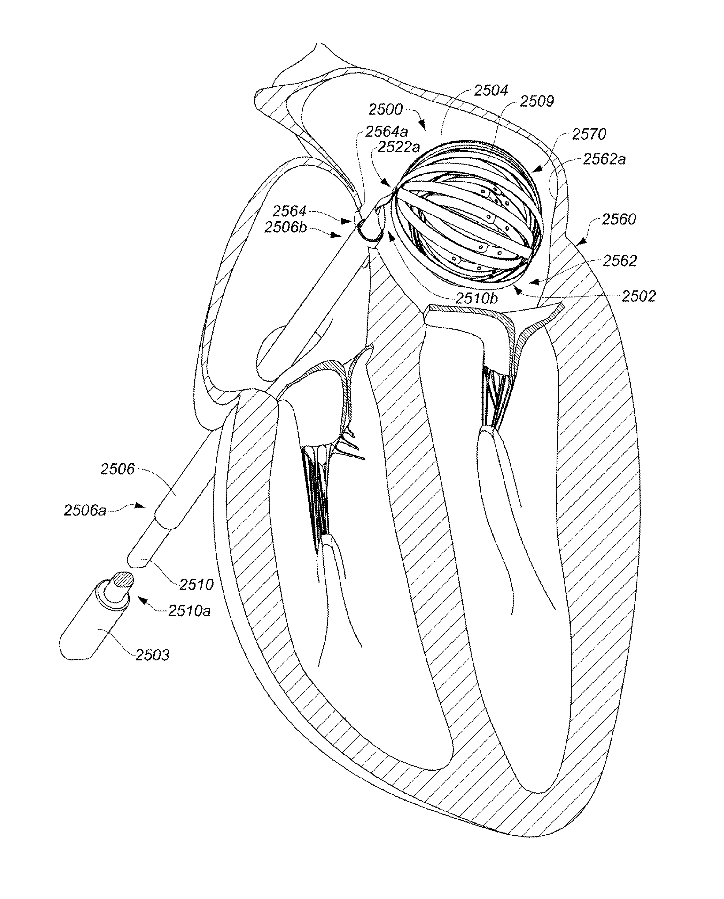 Enhanced medical device for use in bodily cavities, for example an atrium