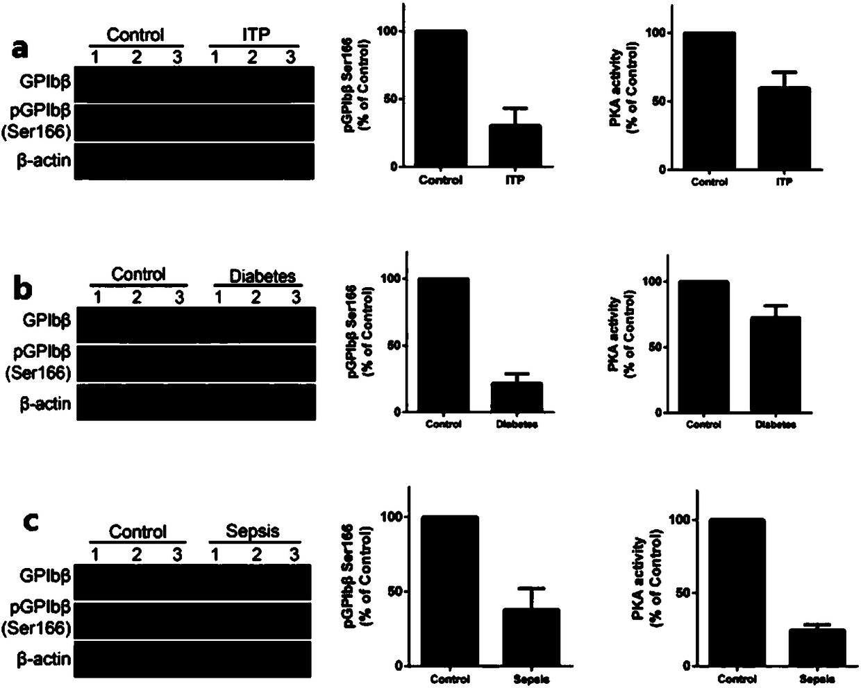 Use of protein kinase A activator in preparation of medicament for treating diseases related to reduction of number of platelets