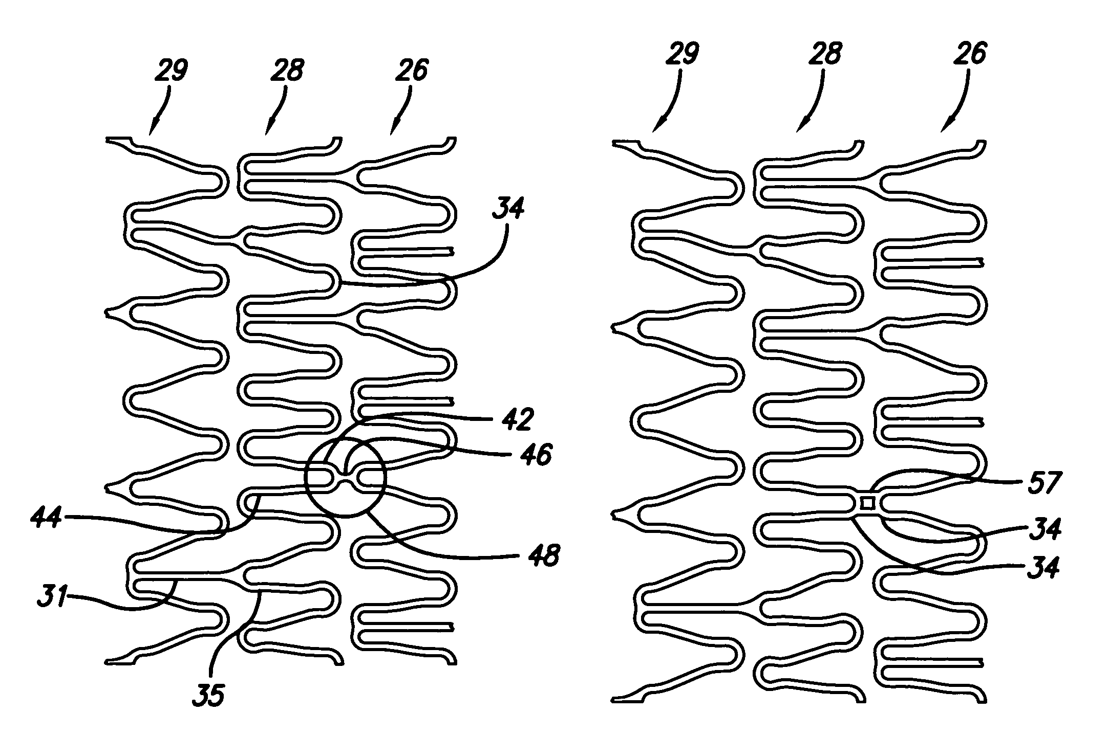 Portal design for stent for treating bifurcated vessels