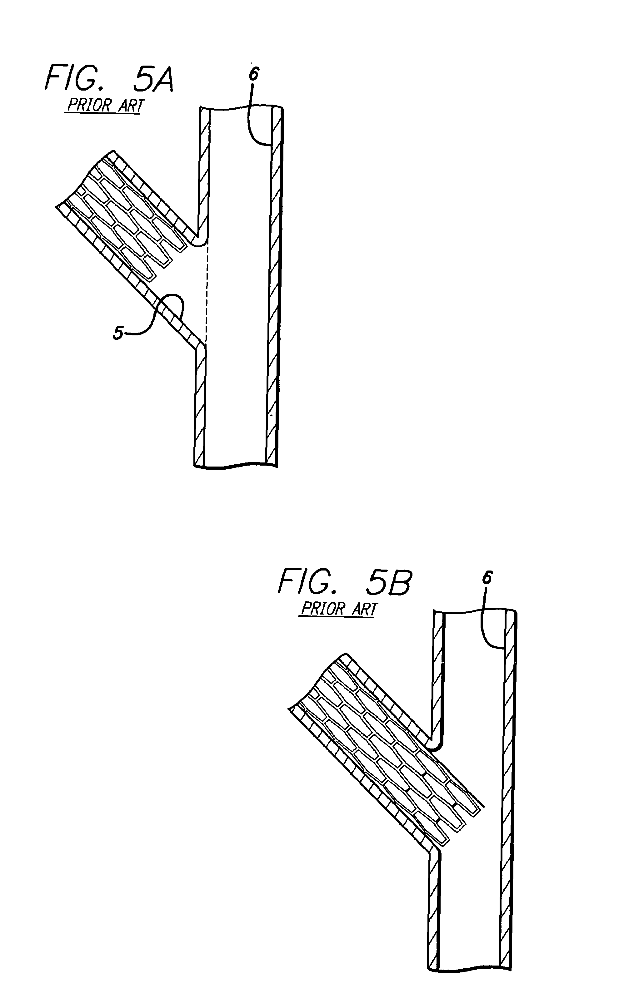 Portal design for stent for treating bifurcated vessels