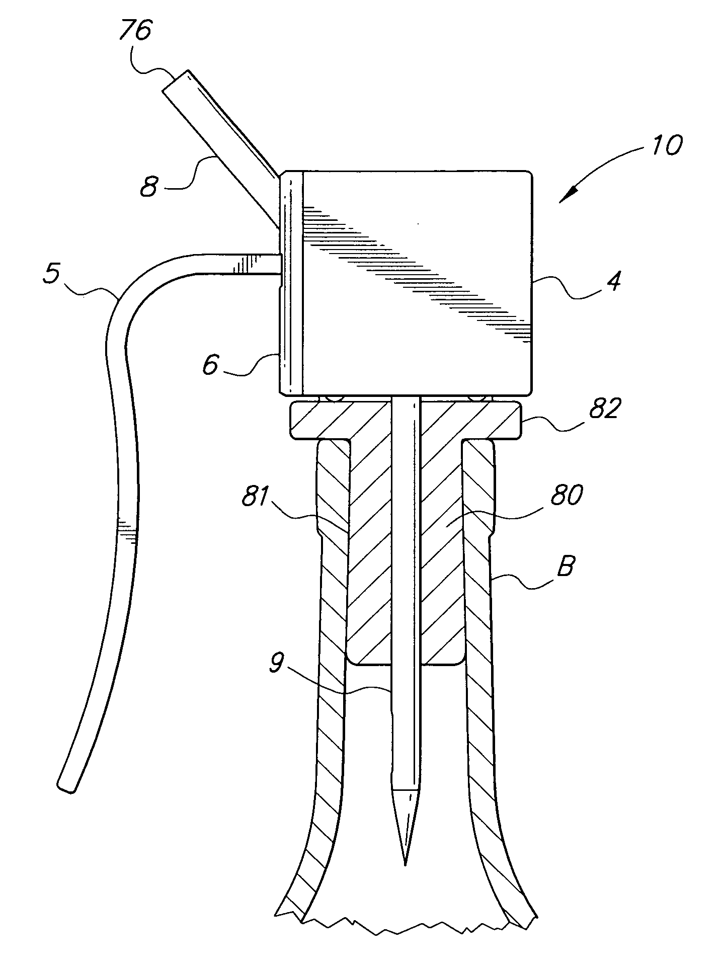 Wine bottle sealing and dispensing device