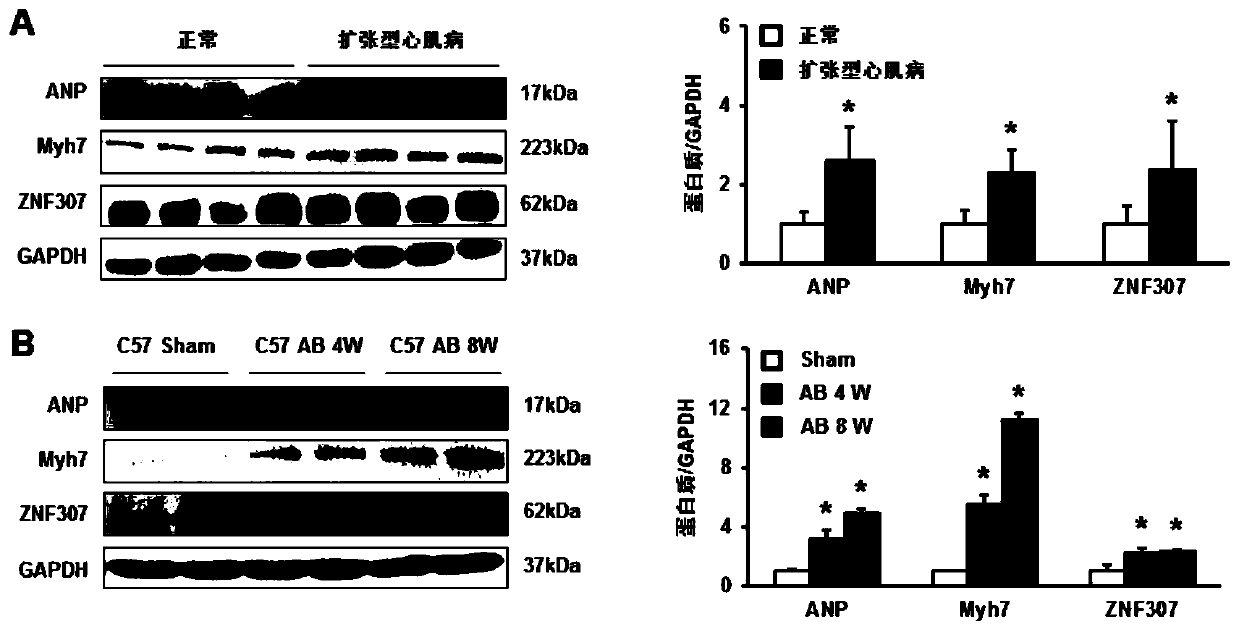 Application of zinc finger protein 307 (znf307) in the treatment of cardiac hypertrophy