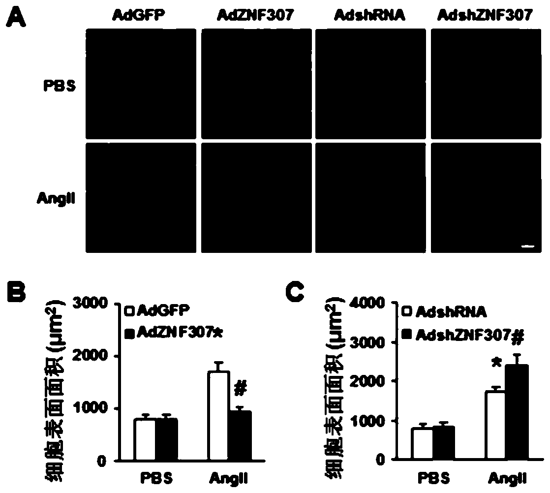 Application of zinc finger protein 307 (znf307) in the treatment of cardiac hypertrophy