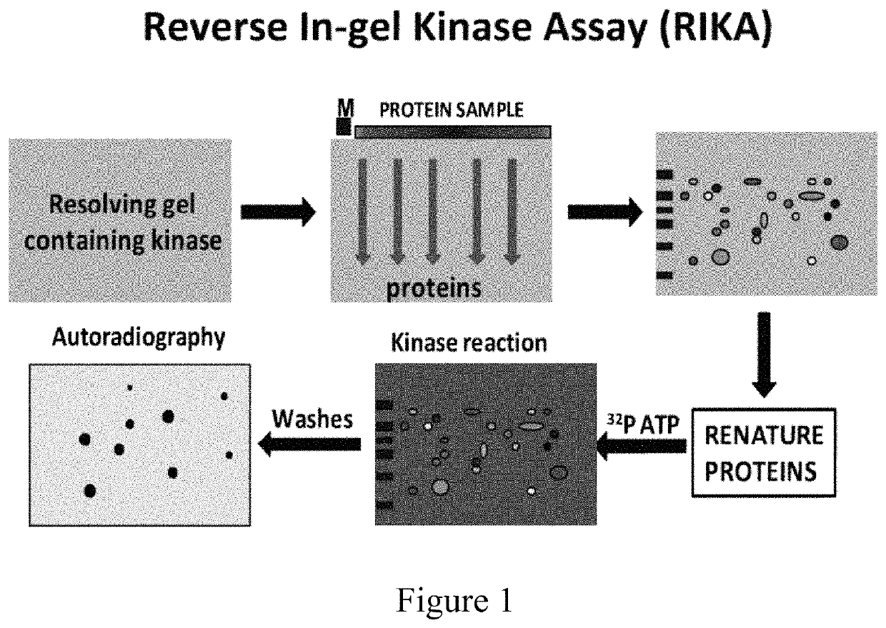 PIM kinase inhibitors in combination with RNA splicing modulators/inhibitors for treatment of cancers