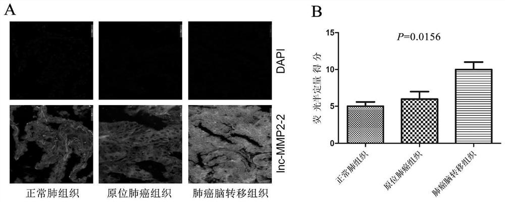 A kit for screening cancer brain metastases