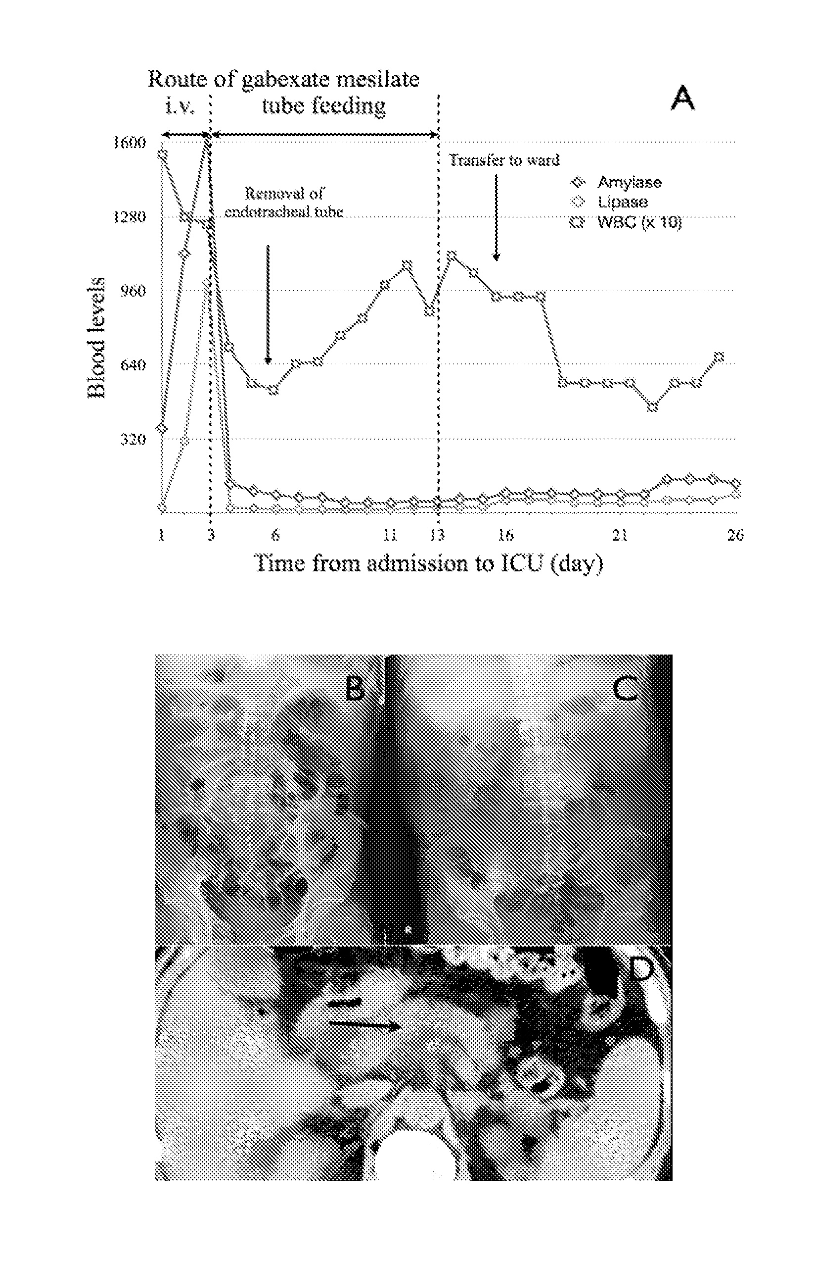 Administration of serine protease inhibitors to the stomach