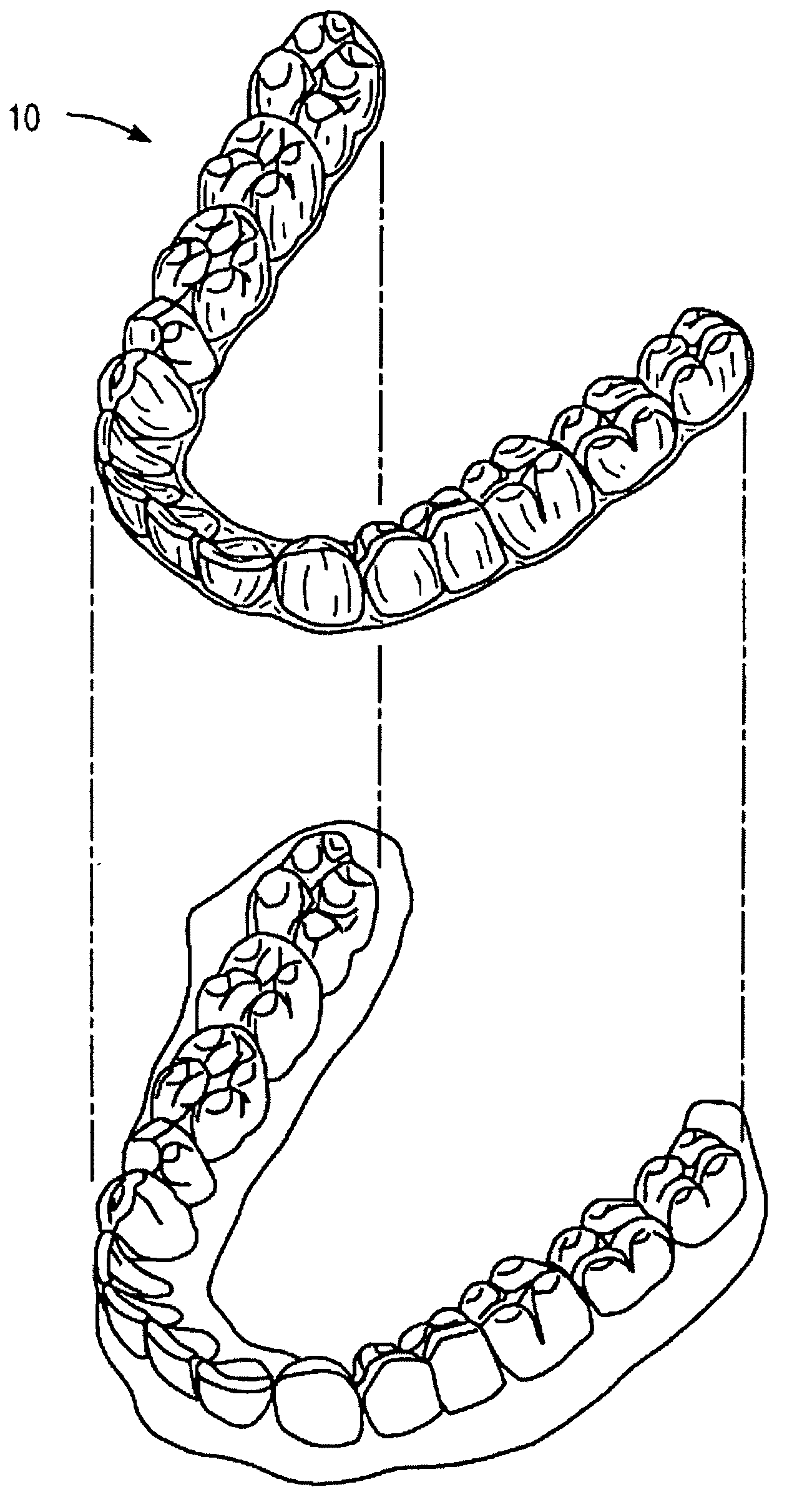 Methods of making orthodontic appliances