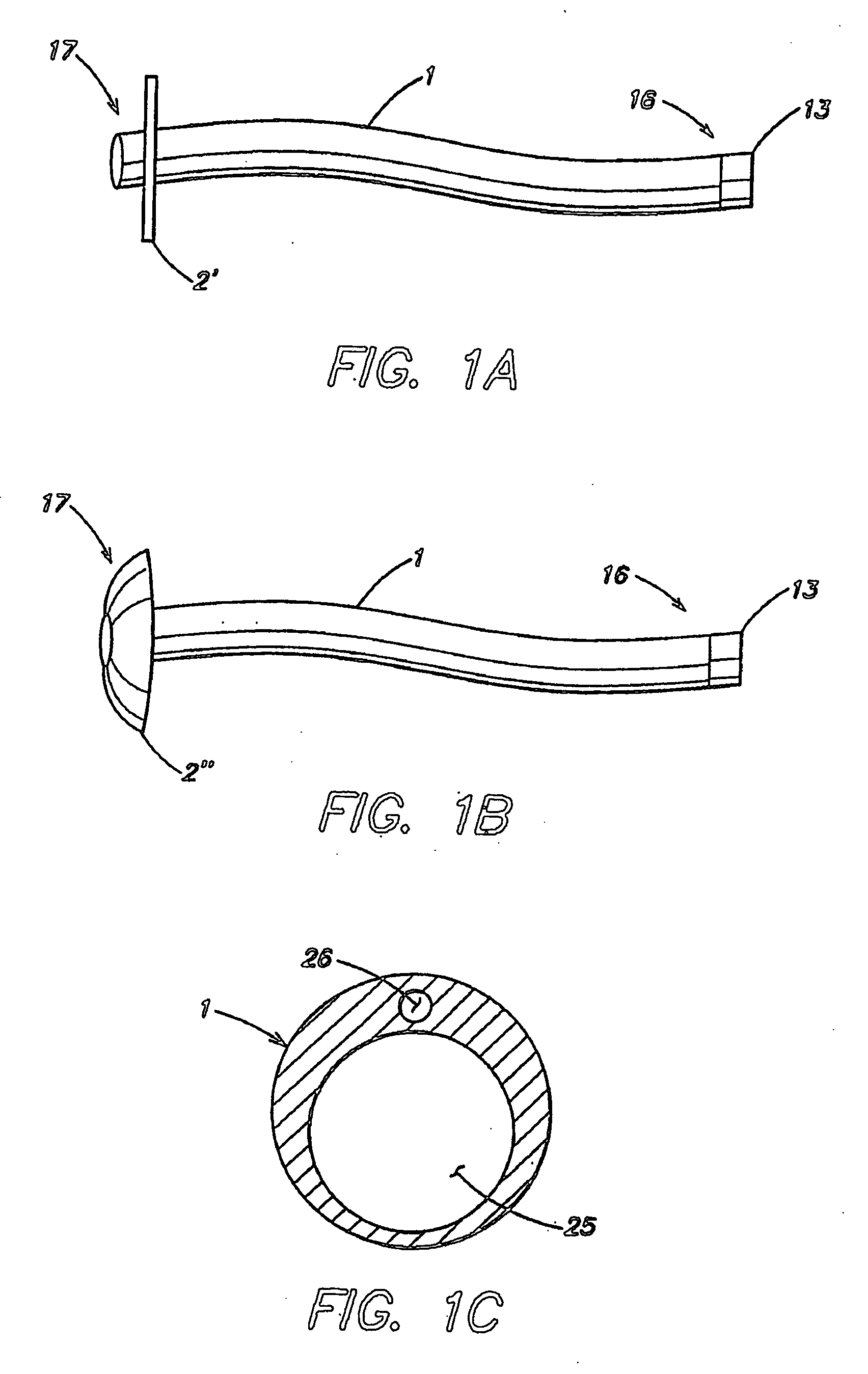 Apparatus for treating obesity by extracting food