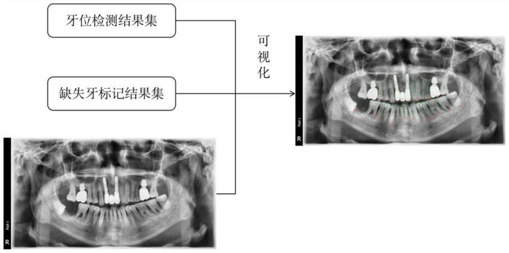 Tooth position detection and missing tooth marking method and device