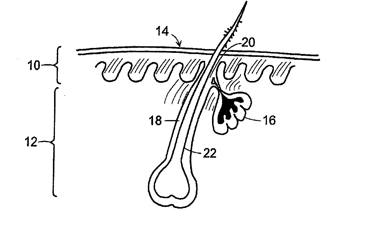 Method of Treating Disorders Associated with Sebaceous Follicles