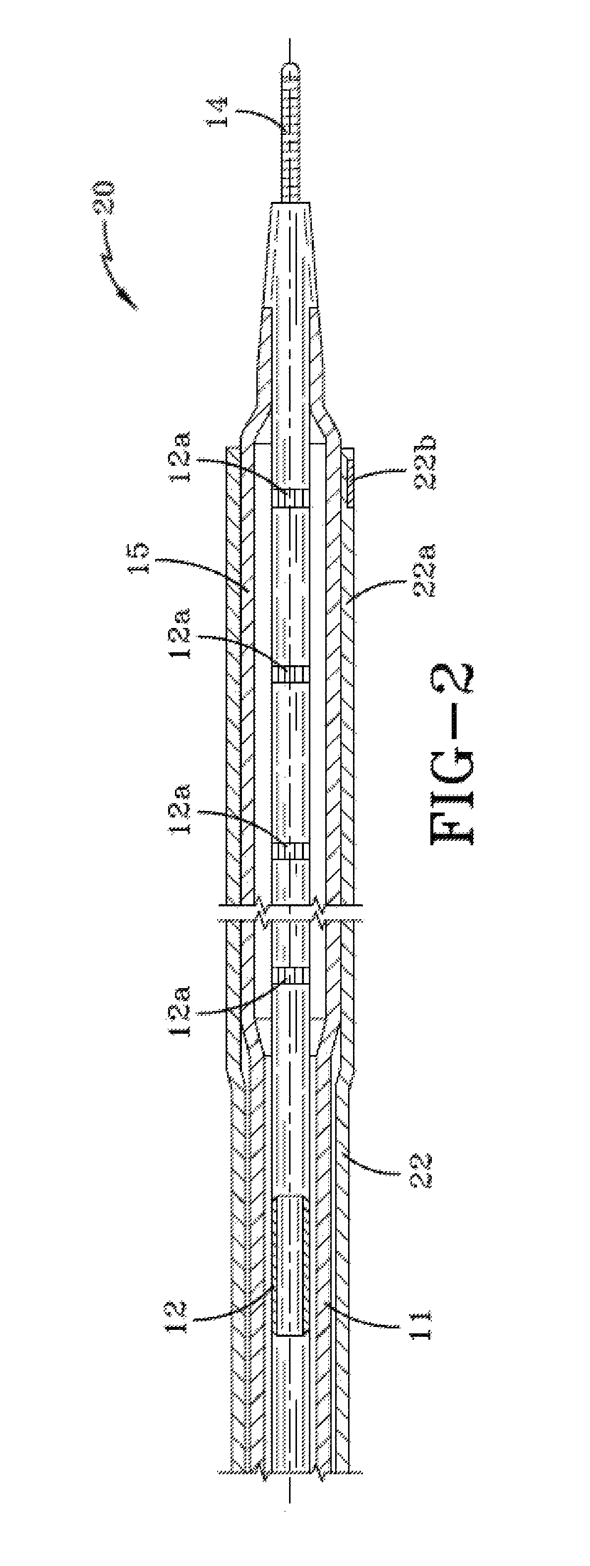 Balloon catheter having a retractable sheath and locking mechanism