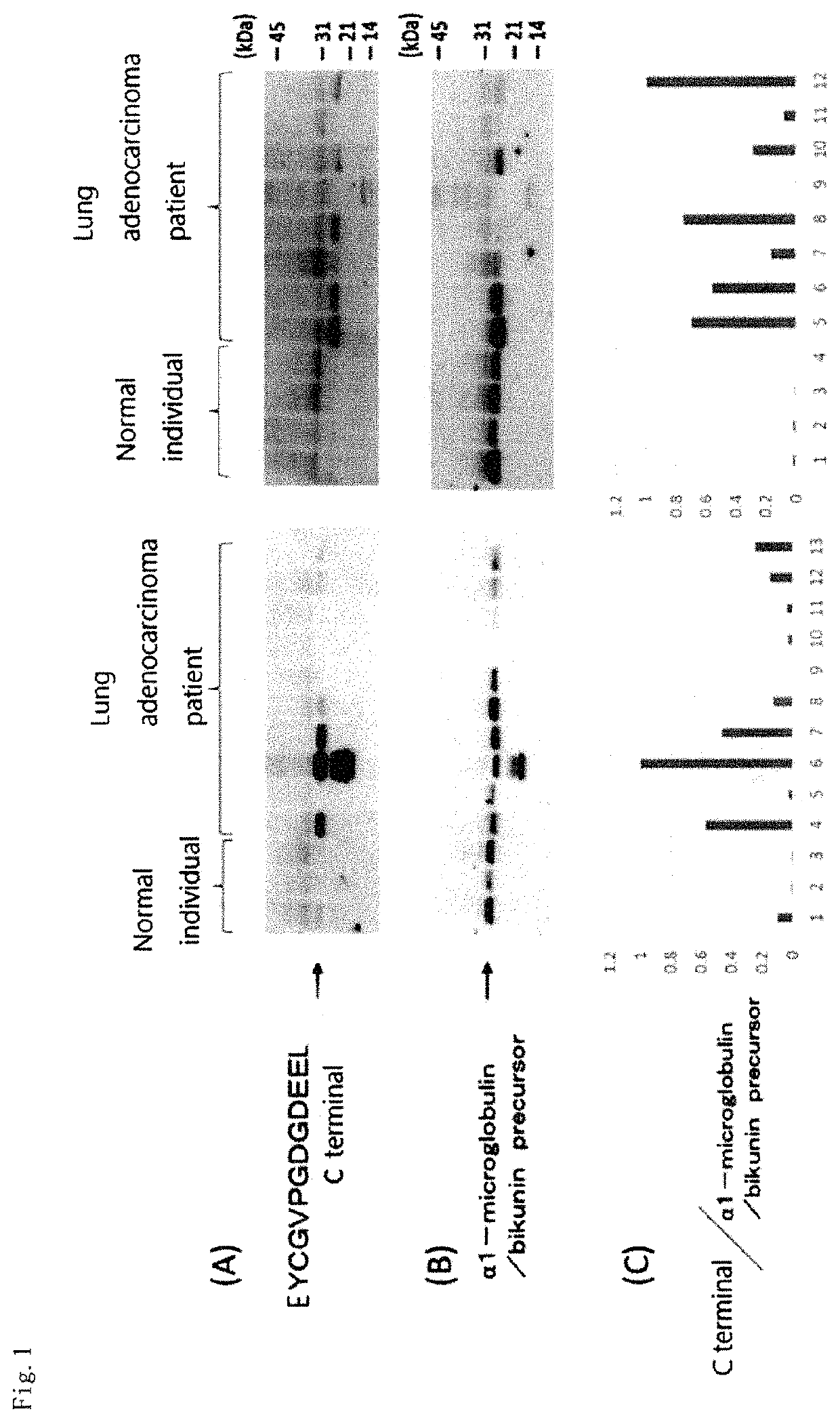 Adenocarcinoma detection method