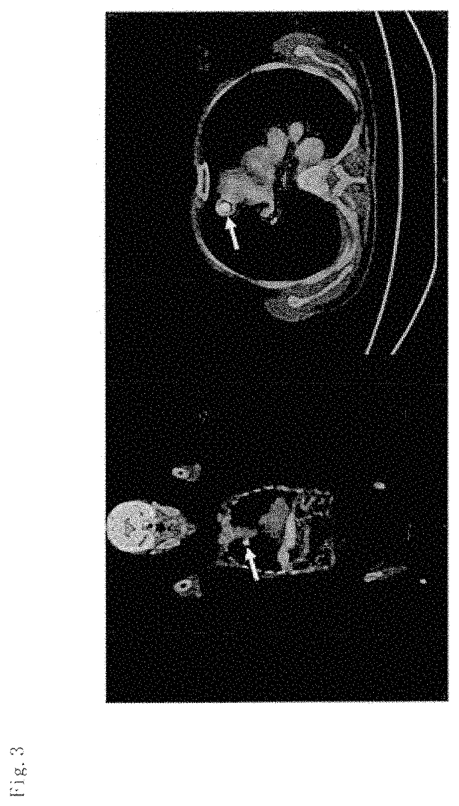 Adenocarcinoma detection method