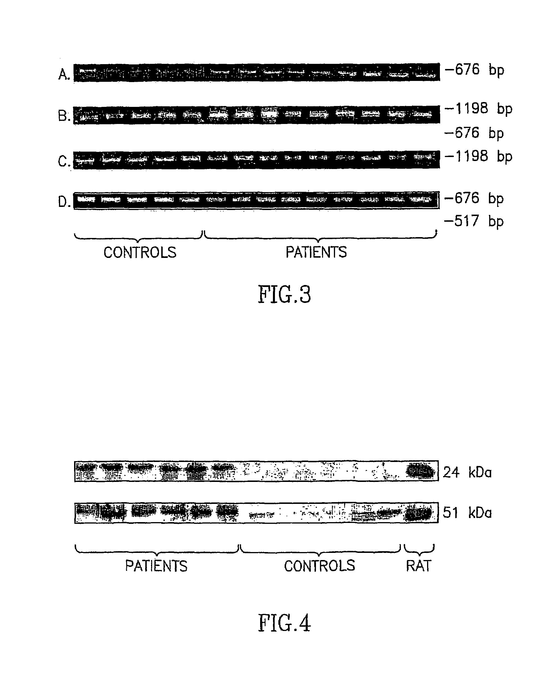 Methods and kits for diagnosis of schizophrenia