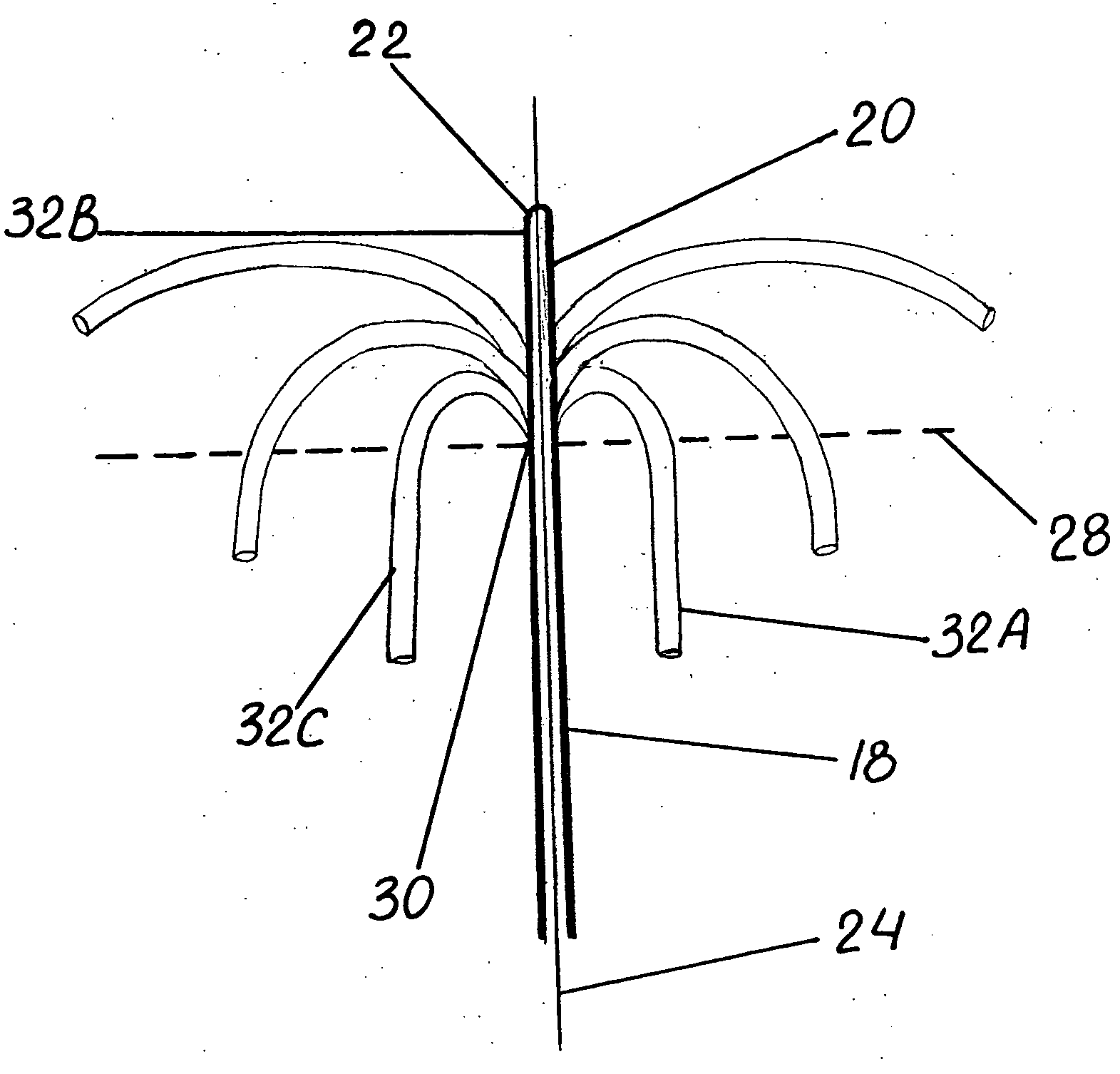 Catheter apparatus for treatment of heart arrhythmia