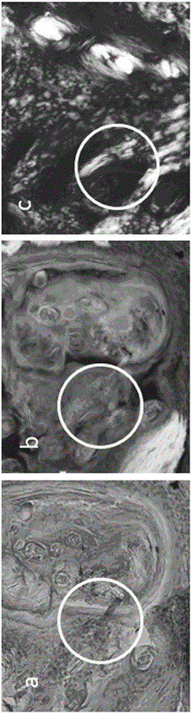 Cell transplantation culture method for forming bone tissue in vivo