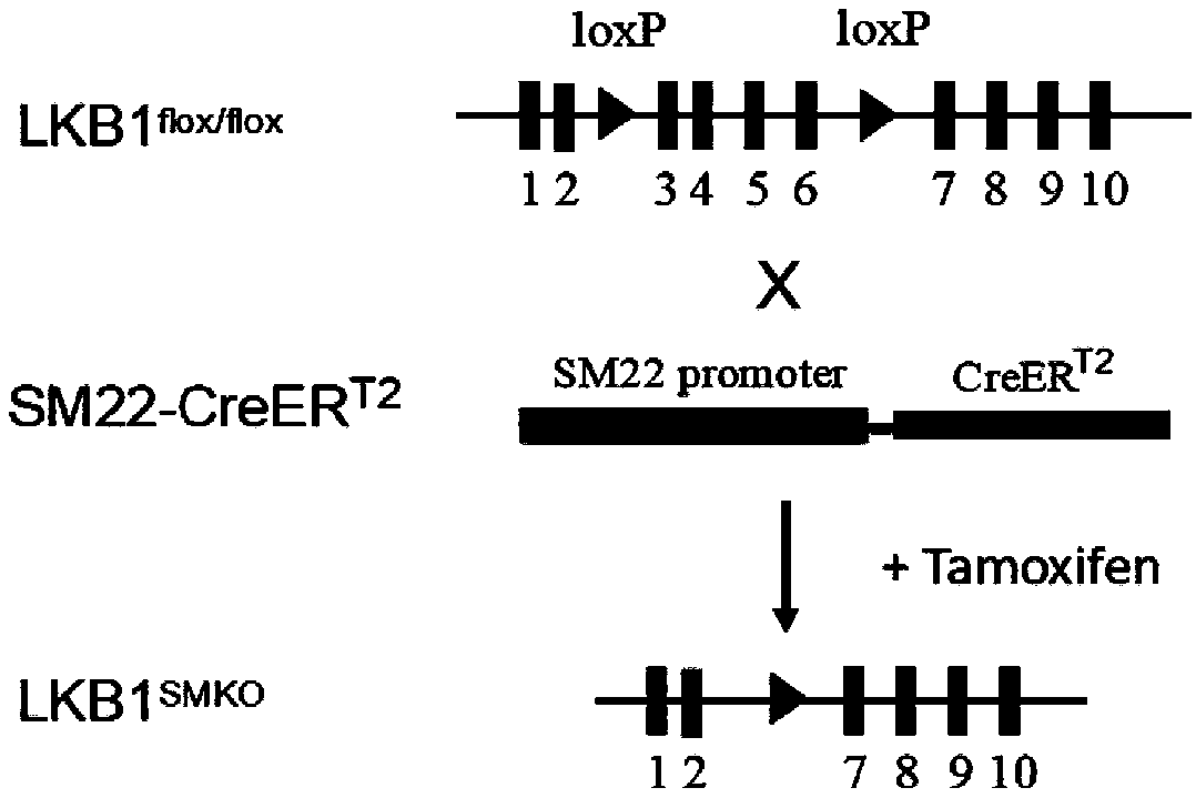 Application of LKB1 gene in preparation of anti-abdominal-aortic-aneurysm drugs