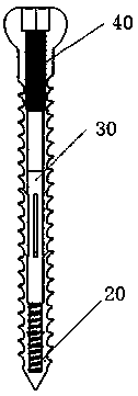 Elastic barb medical bone screw