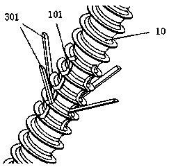 Elastic barb medical bone screw