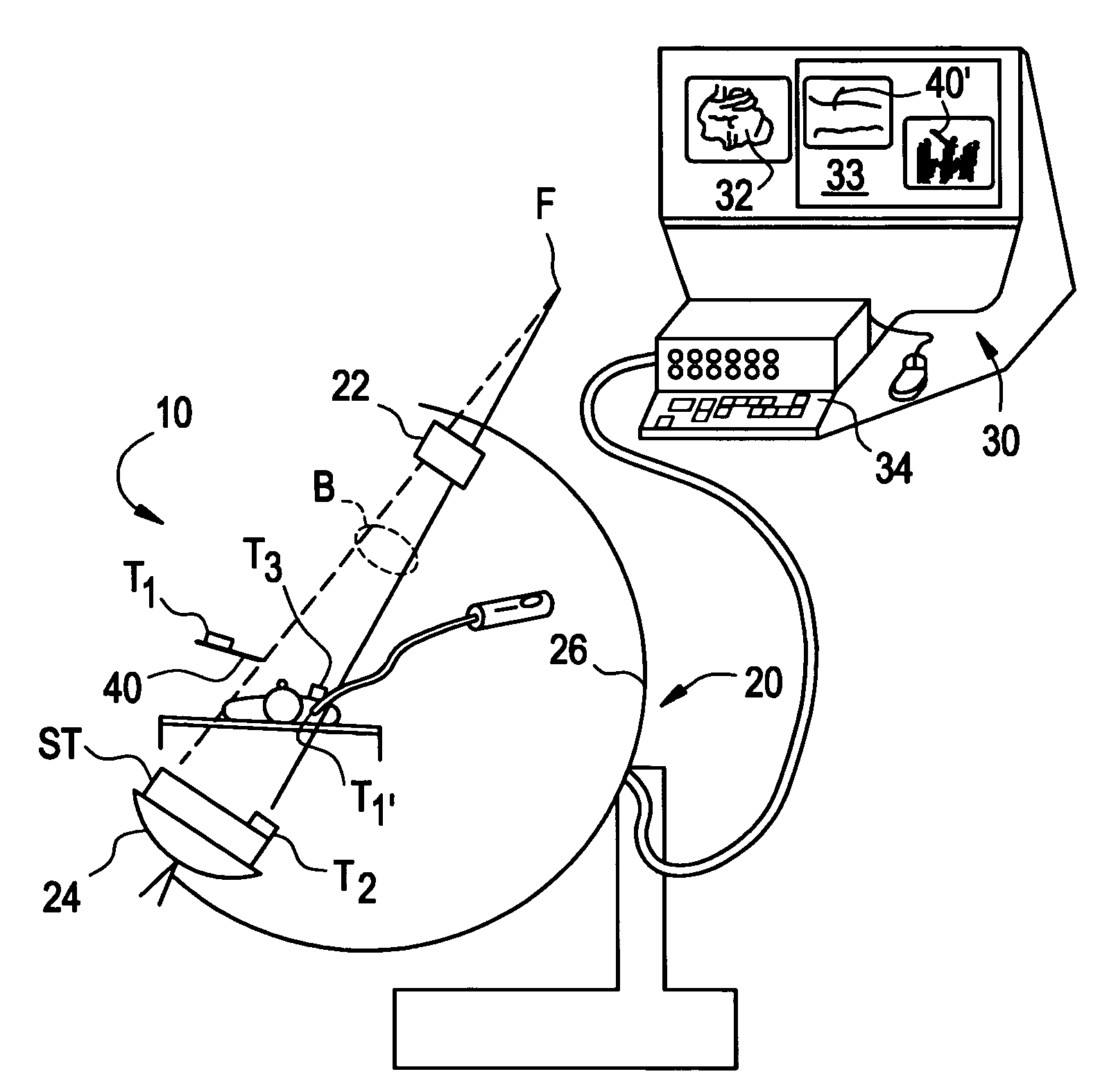 System and method for integration of a calibration target into a C-arm