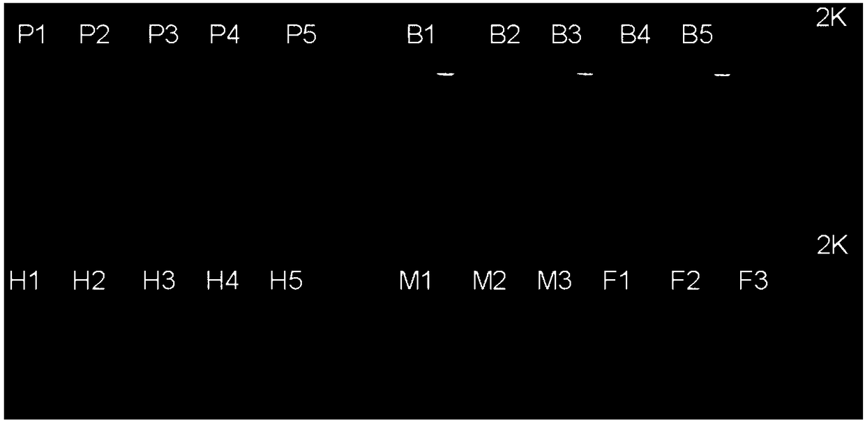 Primer for detecting botryosphaeria dothidea of kiwi fruit and detection method and application