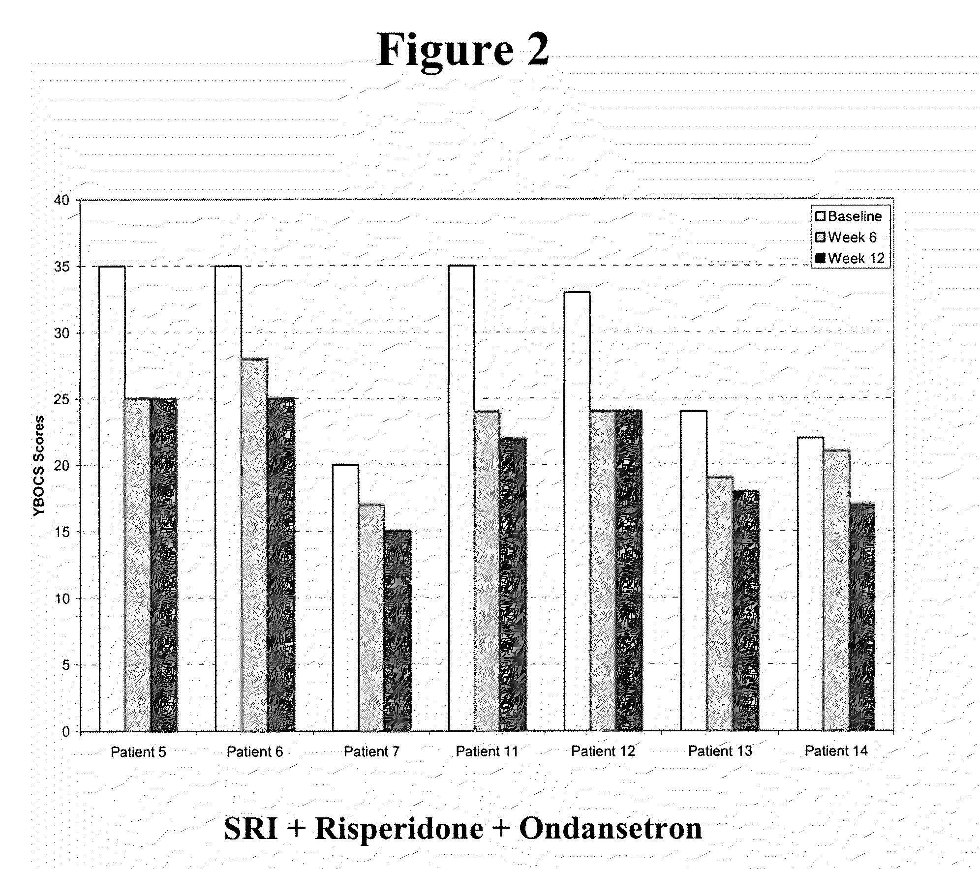 Method of treatment of obsessive compulsive disorder with ondansetron