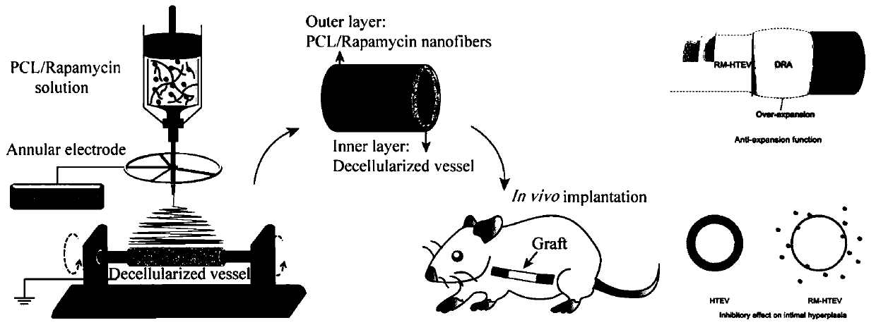 Drug-carrying small-caliber intravascular stent and preparation method thereof