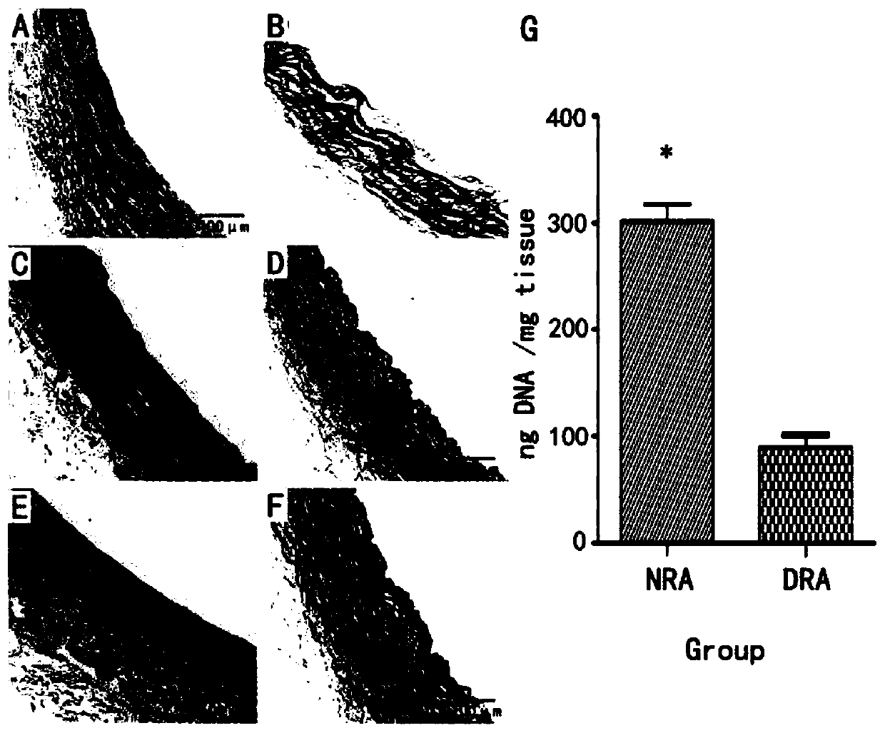 Drug-carrying small-caliber intravascular stent and preparation method thereof