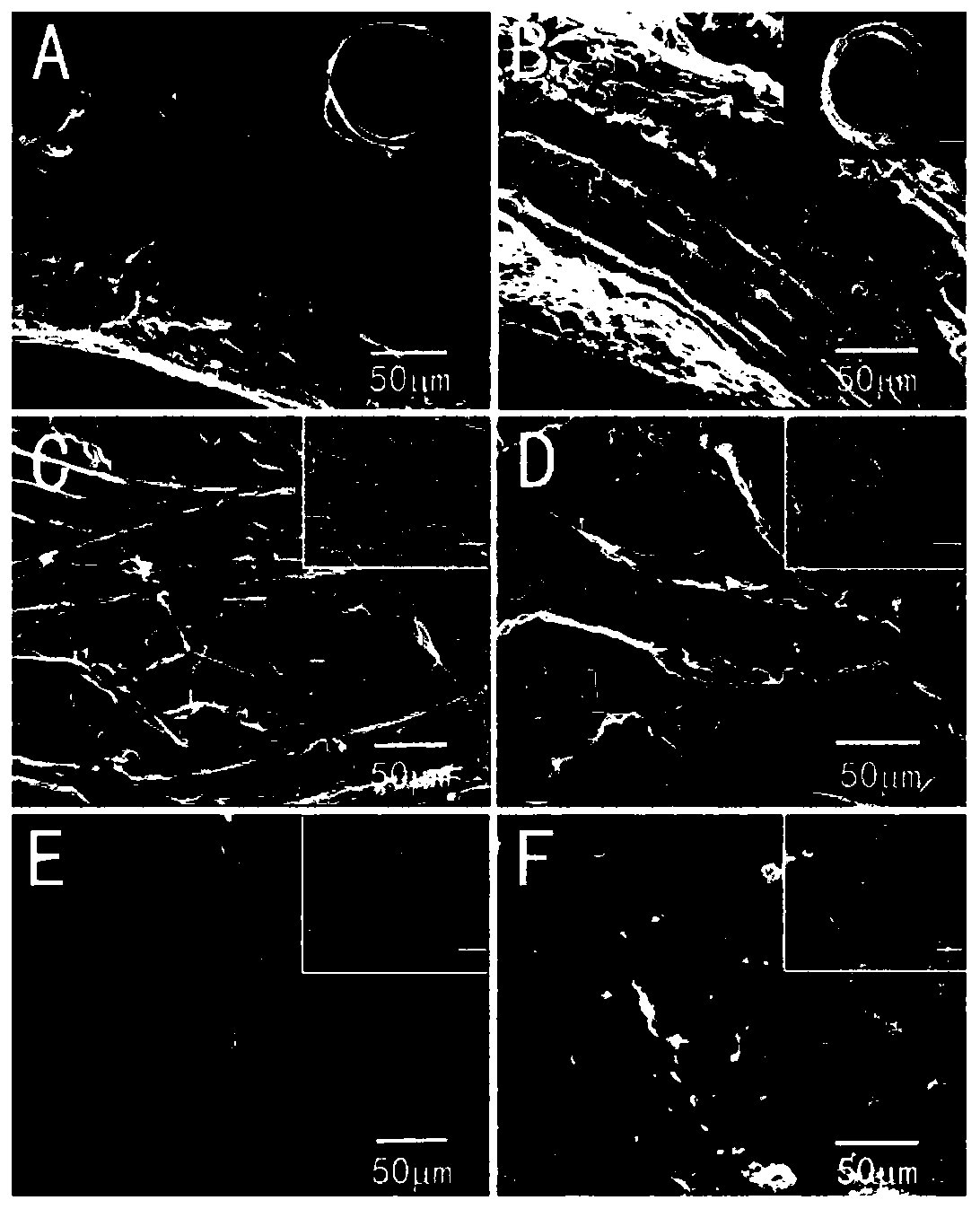 Drug-carrying small-caliber intravascular stent and preparation method thereof