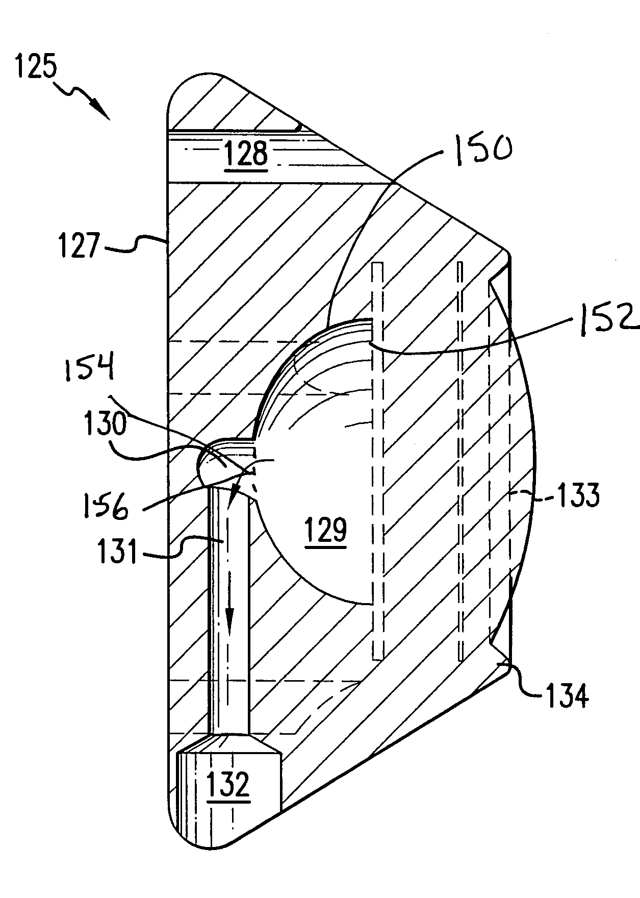 Implantable access port