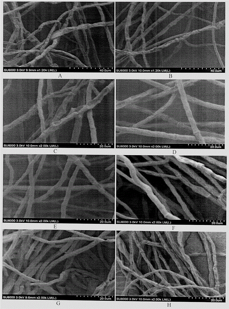 Method for preparing trichophyton scanning electron microscope sample