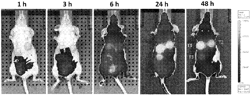 Medicines for targeted diagnosis and photosensitive therapy for cancer and application for same