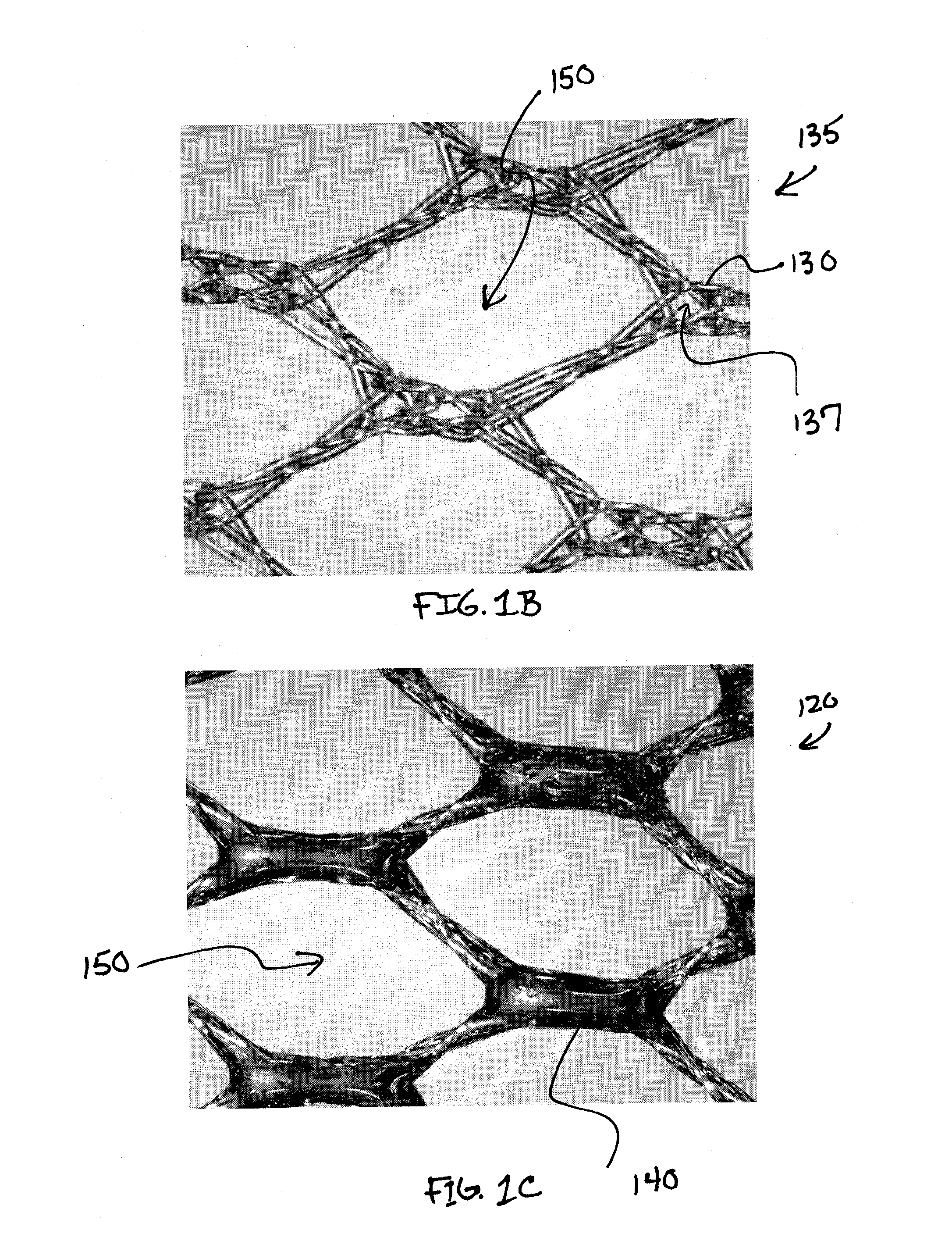 Apparatus and method for limiting surgical adhesions