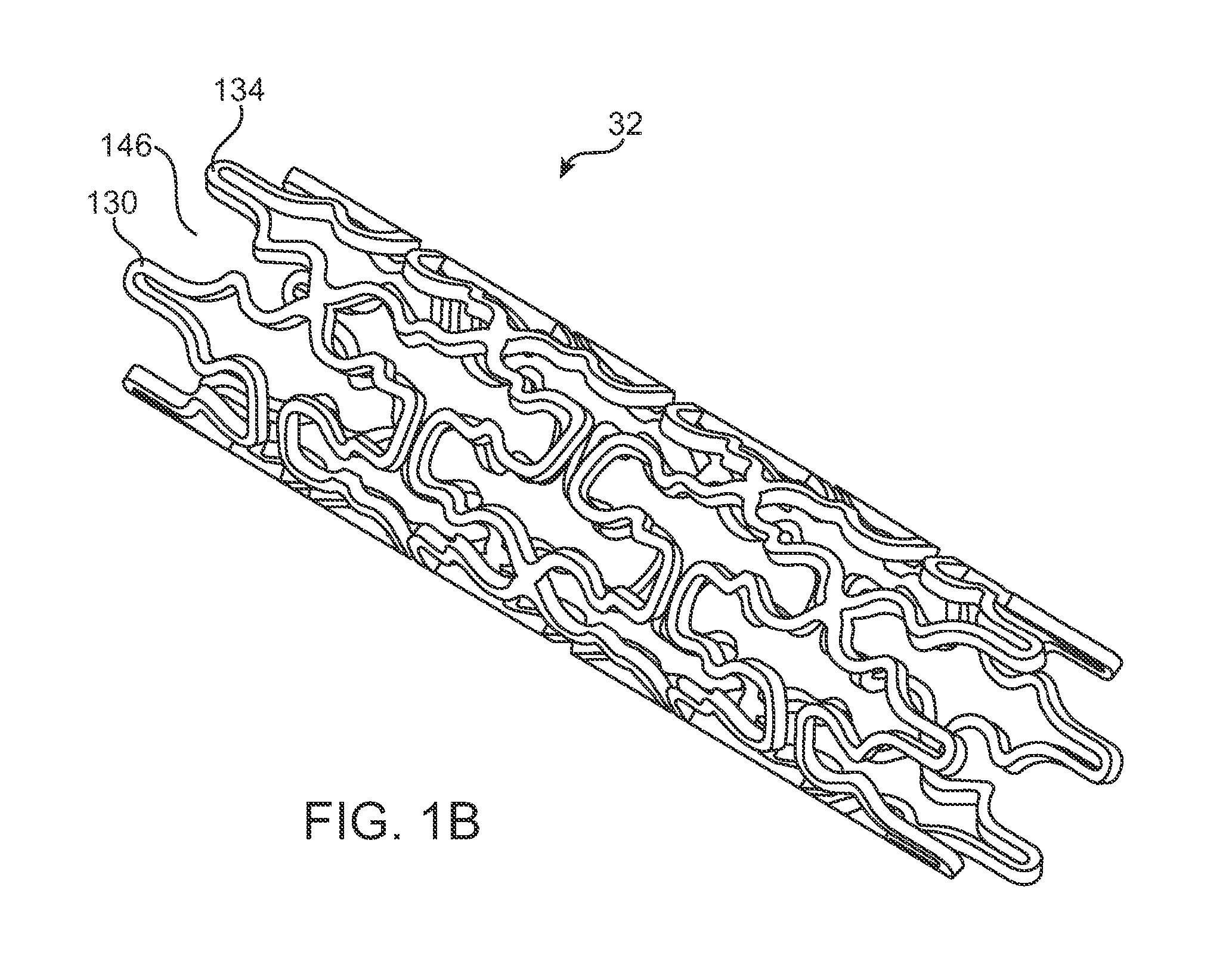 Use of plasma in formation of biodegradable stent coating