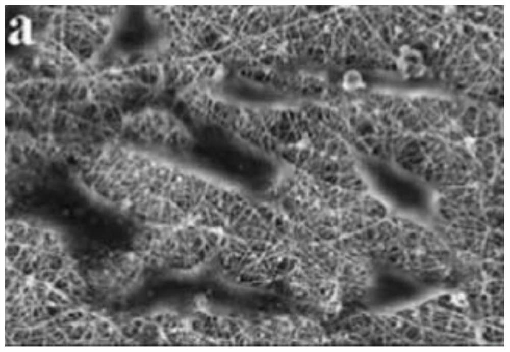 Preparation method of wound repair material with cell growth regulation and control function