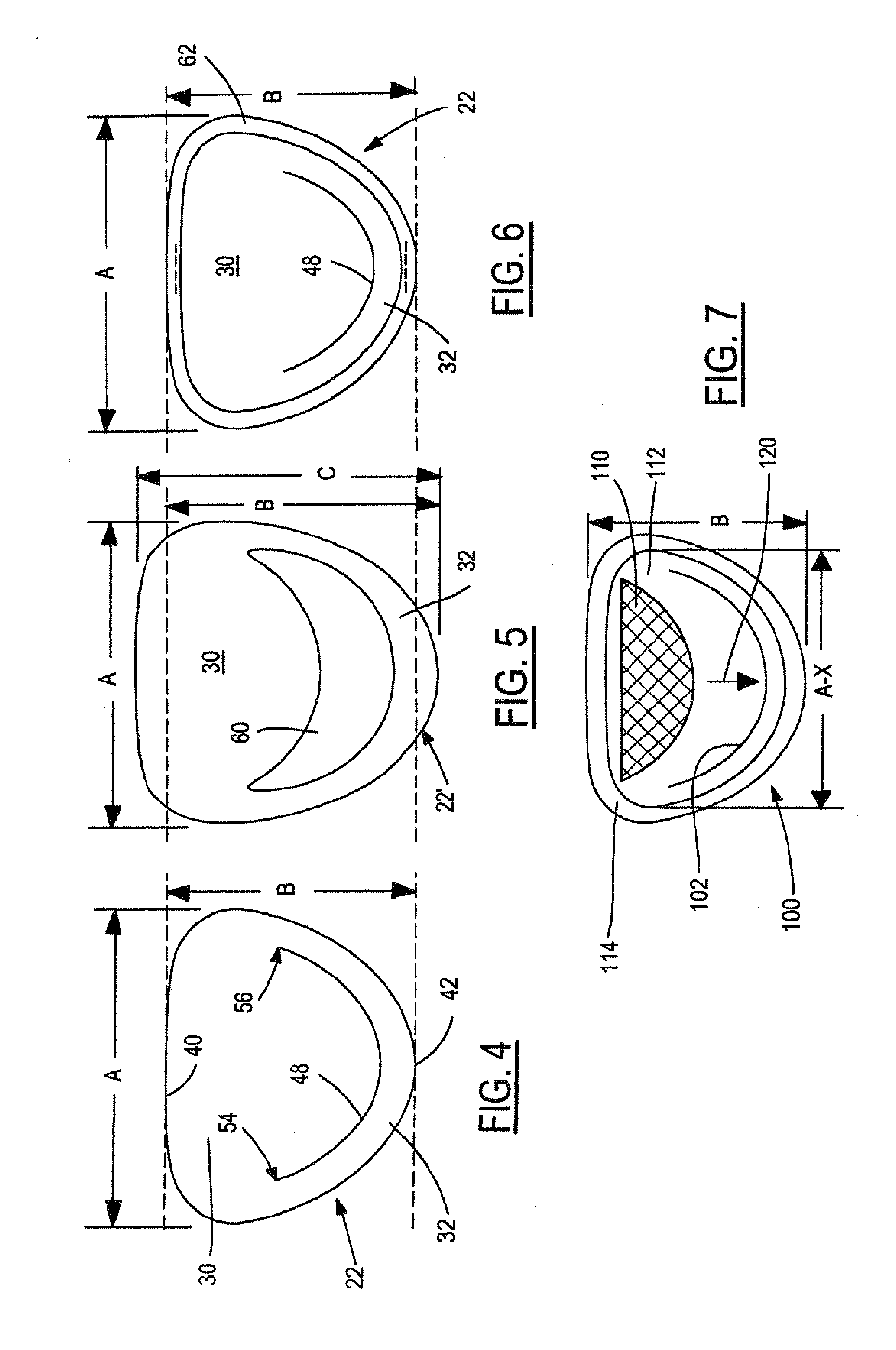 Method and system for treatment of regurgitating heart valves