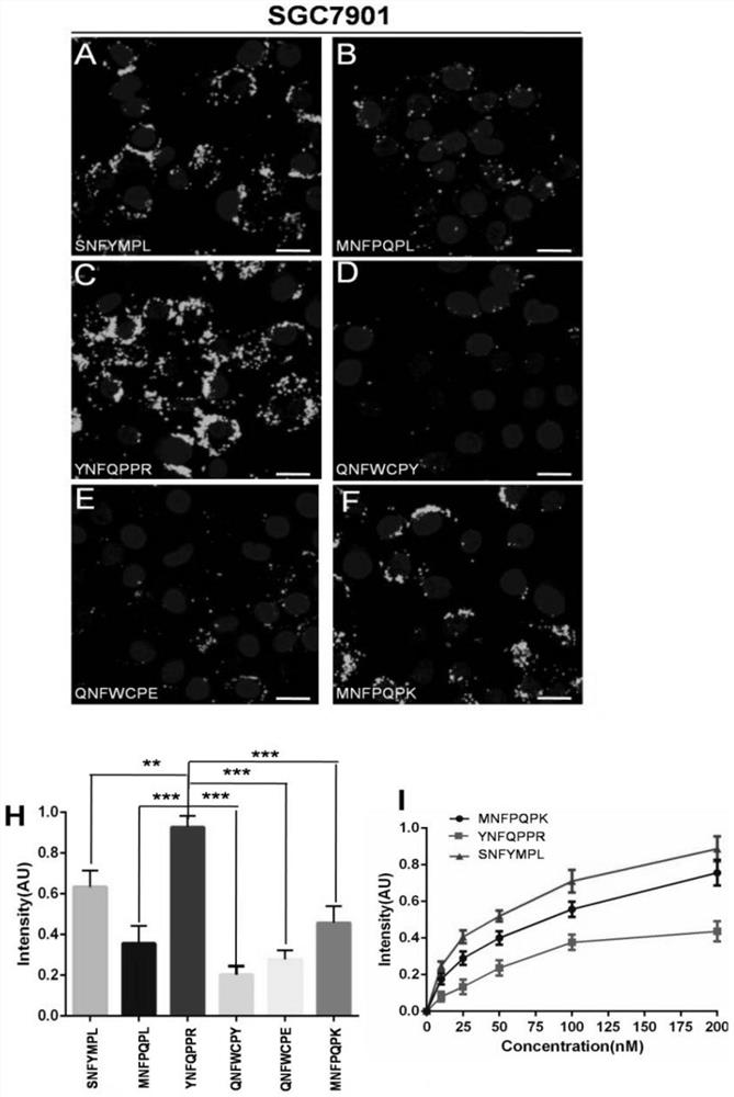 High-affinity early gastric cancer combined near-infrared probe and preparation method thereof