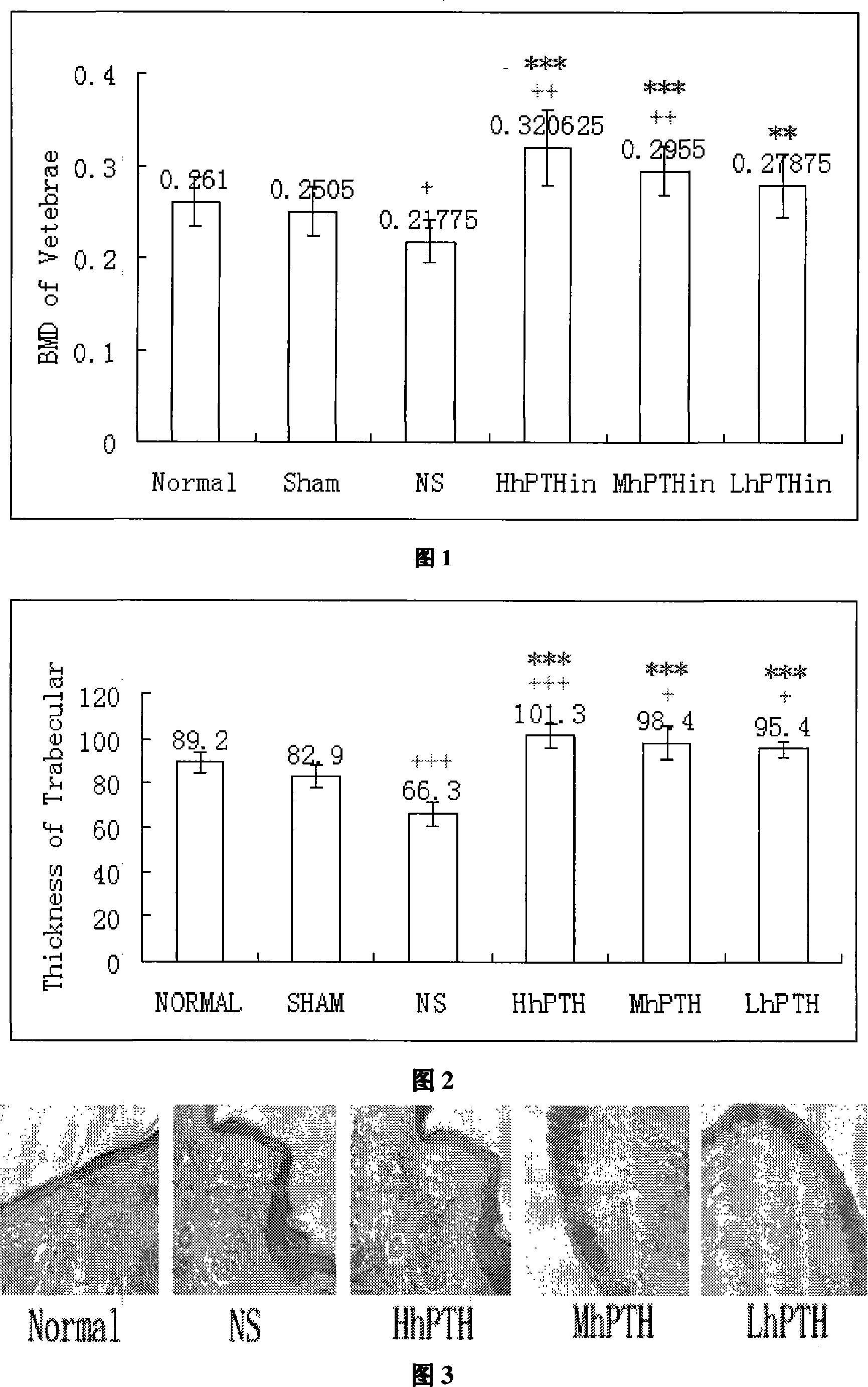 Novel recombinant parathyroid hormone (1-34) correlated peptide nose drops