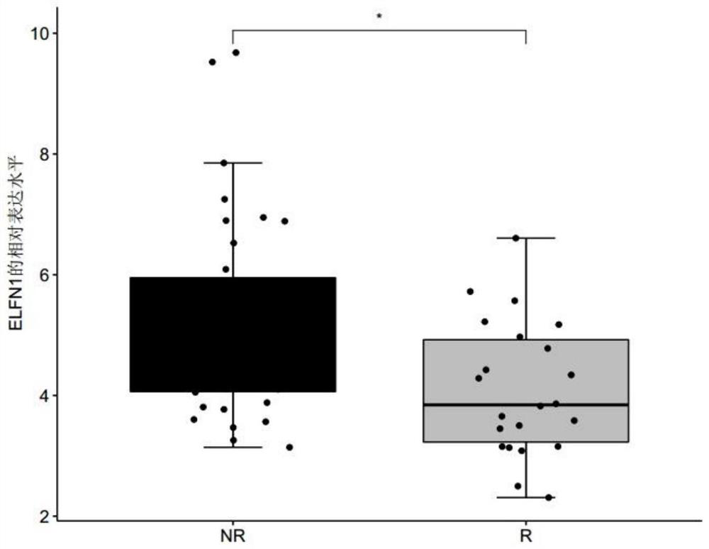 Biomarker for predicting tumor drug sensitivity and related product thereof