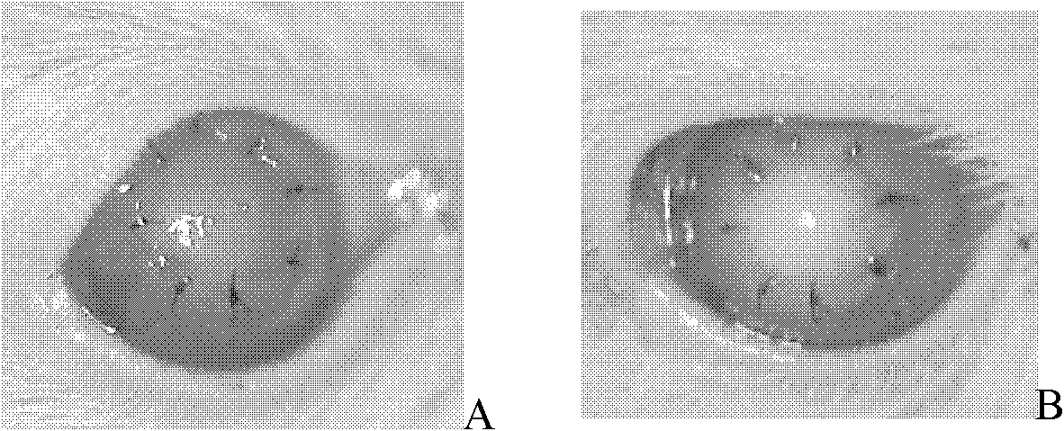 Nano lipid cubic crystal preparation and its preparation method and application