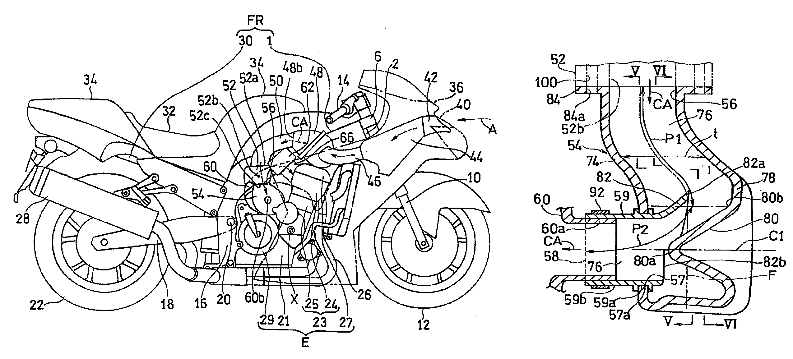 Supercharger intake duct