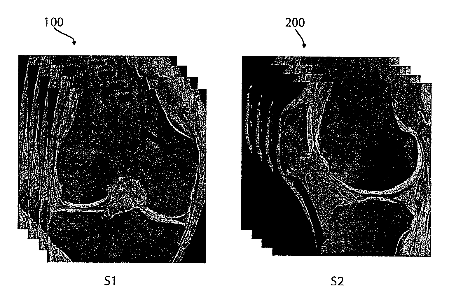 Fusion of Multiple Imaging Planes for Isotropic Imaging in MRI and Quantitative Image Analysis using Isotropic or Near-isotropic Imaging