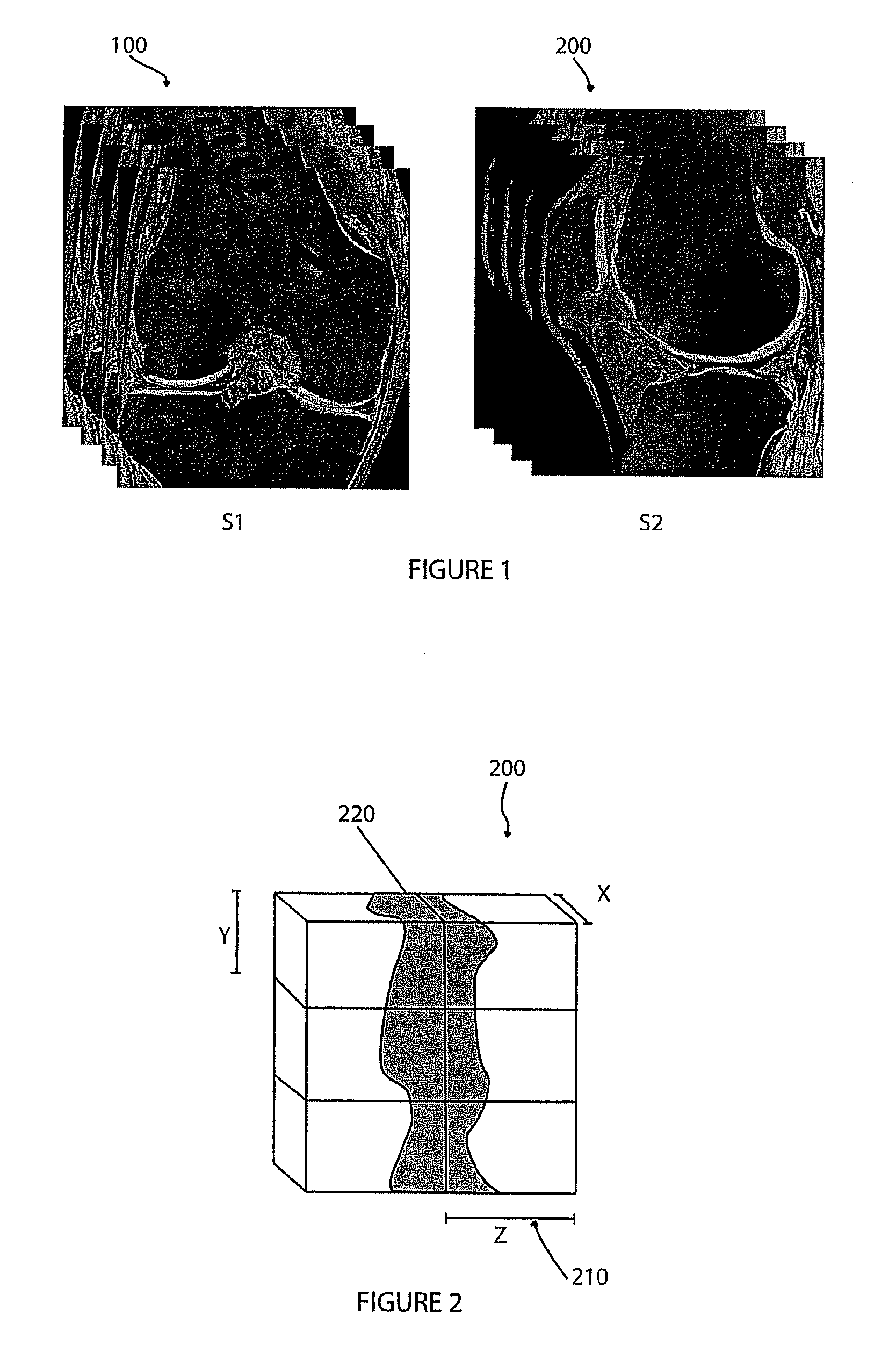 Fusion of Multiple Imaging Planes for Isotropic Imaging in MRI and Quantitative Image Analysis using Isotropic or Near-isotropic Imaging