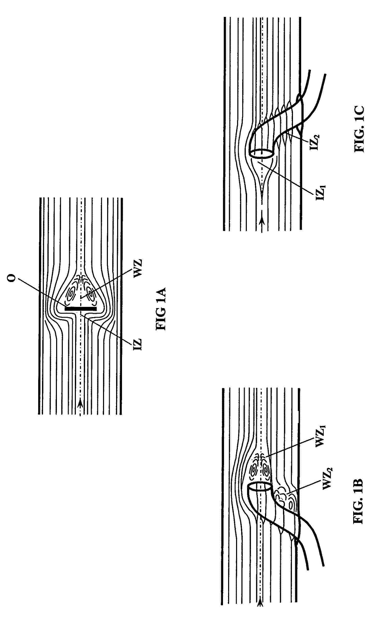 Device for implantation of retrograde ventriculo-sinus shunt